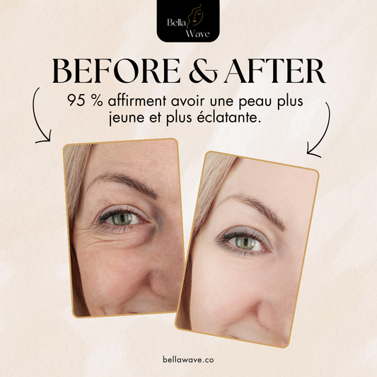SkinLift™ - Bellawave